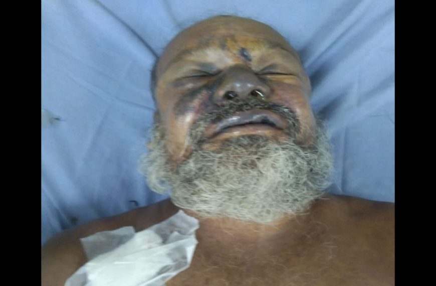 সিরাজদিখানে জমি বিরোধে হামলা: চিকিৎসাধীন অবস্থায় এক ব্যক্তির মৃত্যু, আটক দুই