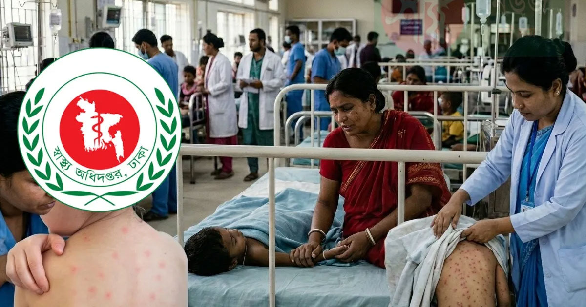 হাম ও হামের উপসর্গ নিয়ে মৃত্যুর মিছিল থামছেই না, আরও ৫ শিশুর প্রাণহানি