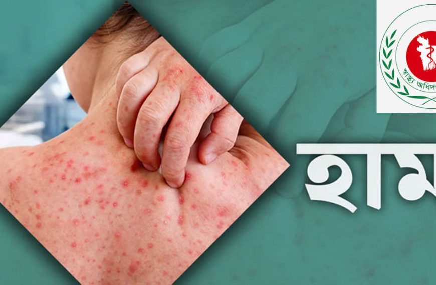 হামের উপসর্গ নিয়ে ৫ শিশুর মৃত্যু, আক্রান্ত ১০৬৯