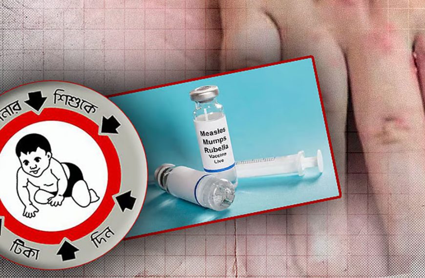 বাদ পড়া শিশুদের জন্য আরও ১৬ লাখ হামের টিকা দেওয়ার সিদ্ধান্ত