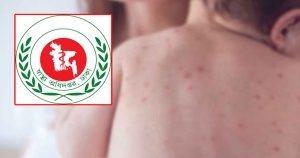 হামে শিশু মৃত্যু থামছেই না, আরও ৫ প্রাণহানি