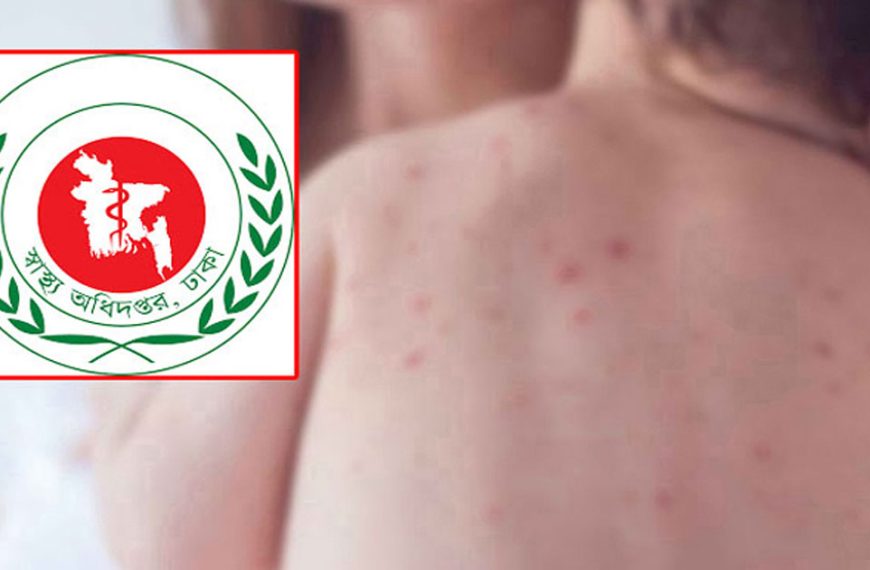 হামে শিশু মৃত্যু থামছেই না, আরও ৫ প্রাণহানি