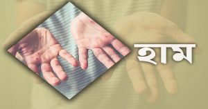 হাম উপসর্গে দেশে গত ২৪ ঘণ্টায় ৬ শিশুর&hellip;