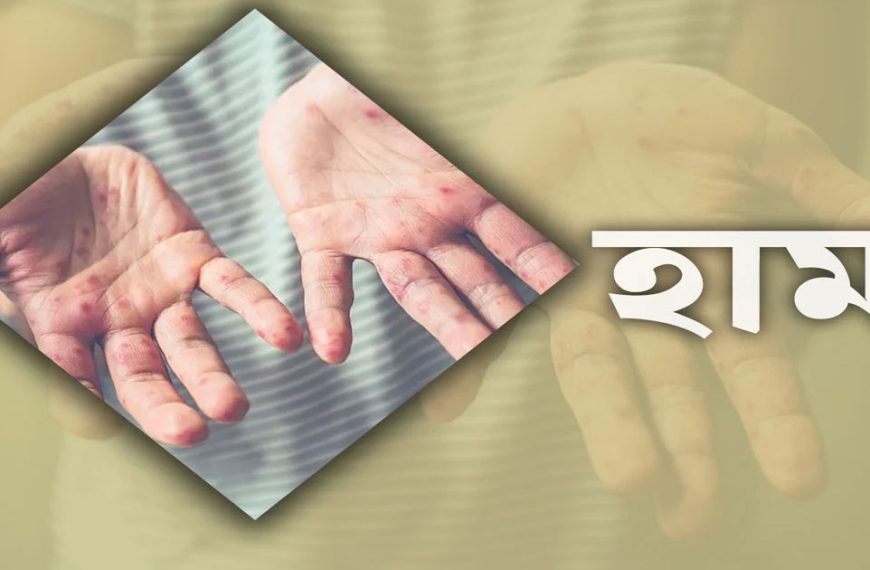 দেশে হামের উপসর্গে ৯ শিশুর প্রাণহানি