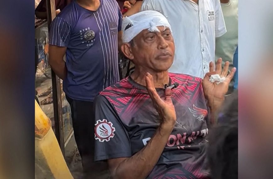 নিজ বাড়ির সামনে অভিনেতা সমু চৌধুরীর মাথা ফাটালেন গ্যারেজ মালিক ও মেকানিক